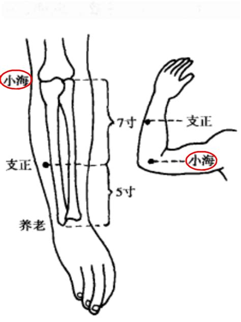 通天穴|通天穴:名稱釋義,別名,功能作用,治法,定位,解剖,主治,操作,臨床運。